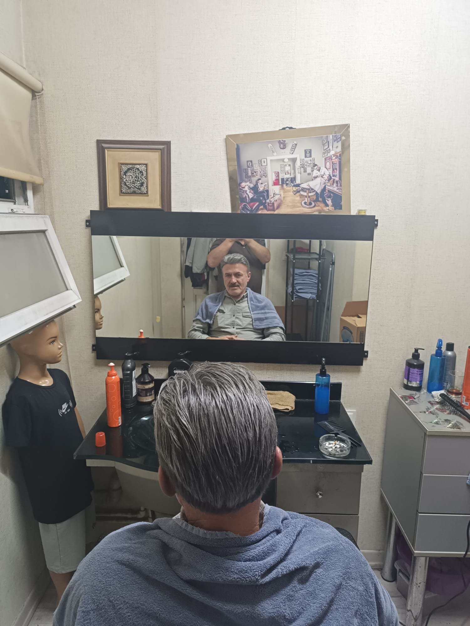 Danışan 01 protez saç çalışması — Eko Hair İstanbul