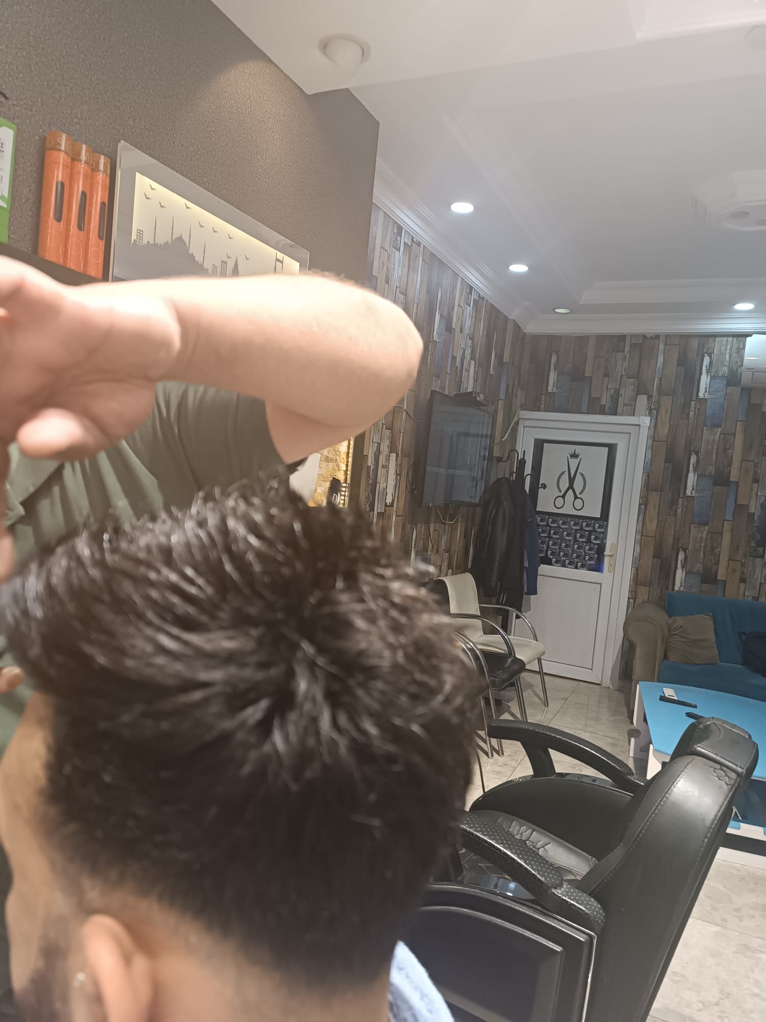 Danışan 02 protez saç çalışması — Eko Hair İstanbul