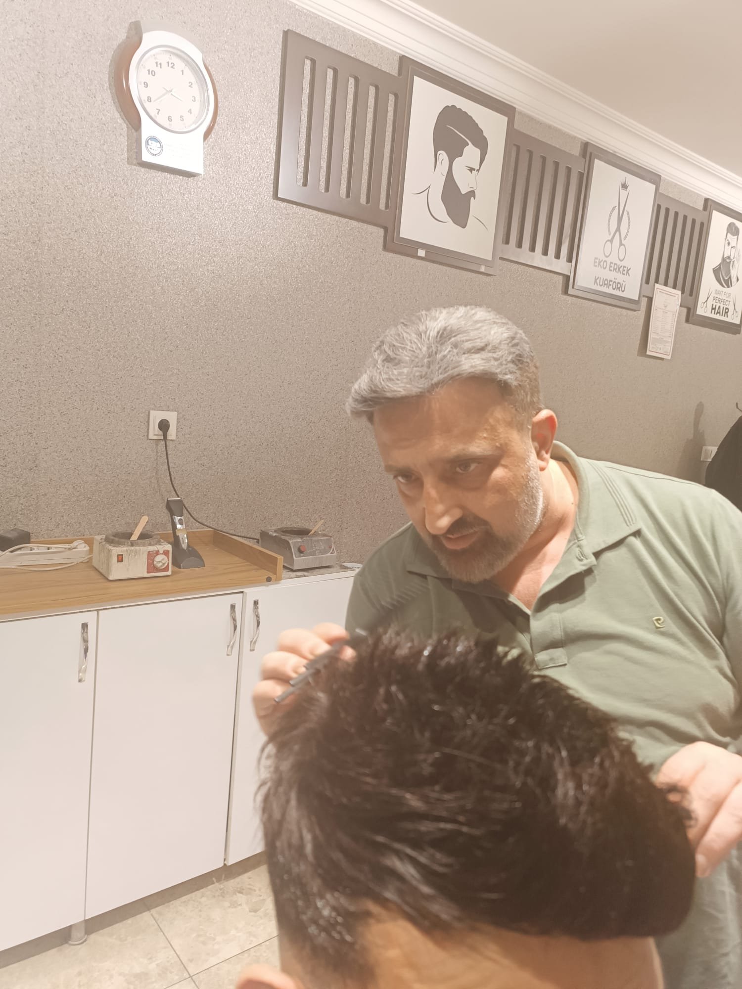Danışan 02 protez saç çalışması — Eko Hair İstanbul