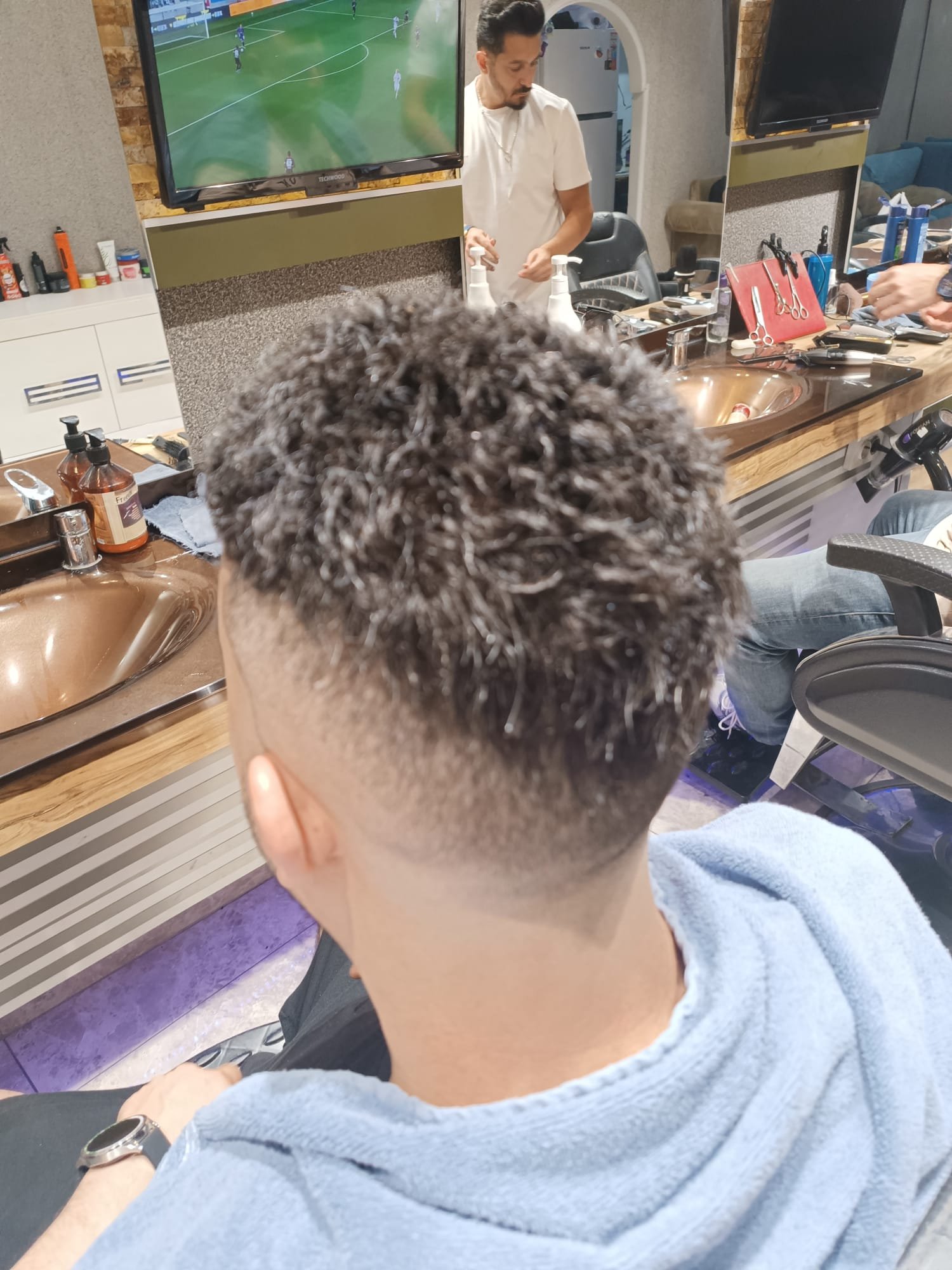 Danışan 03 protez saç çalışması — Eko Hair İstanbul