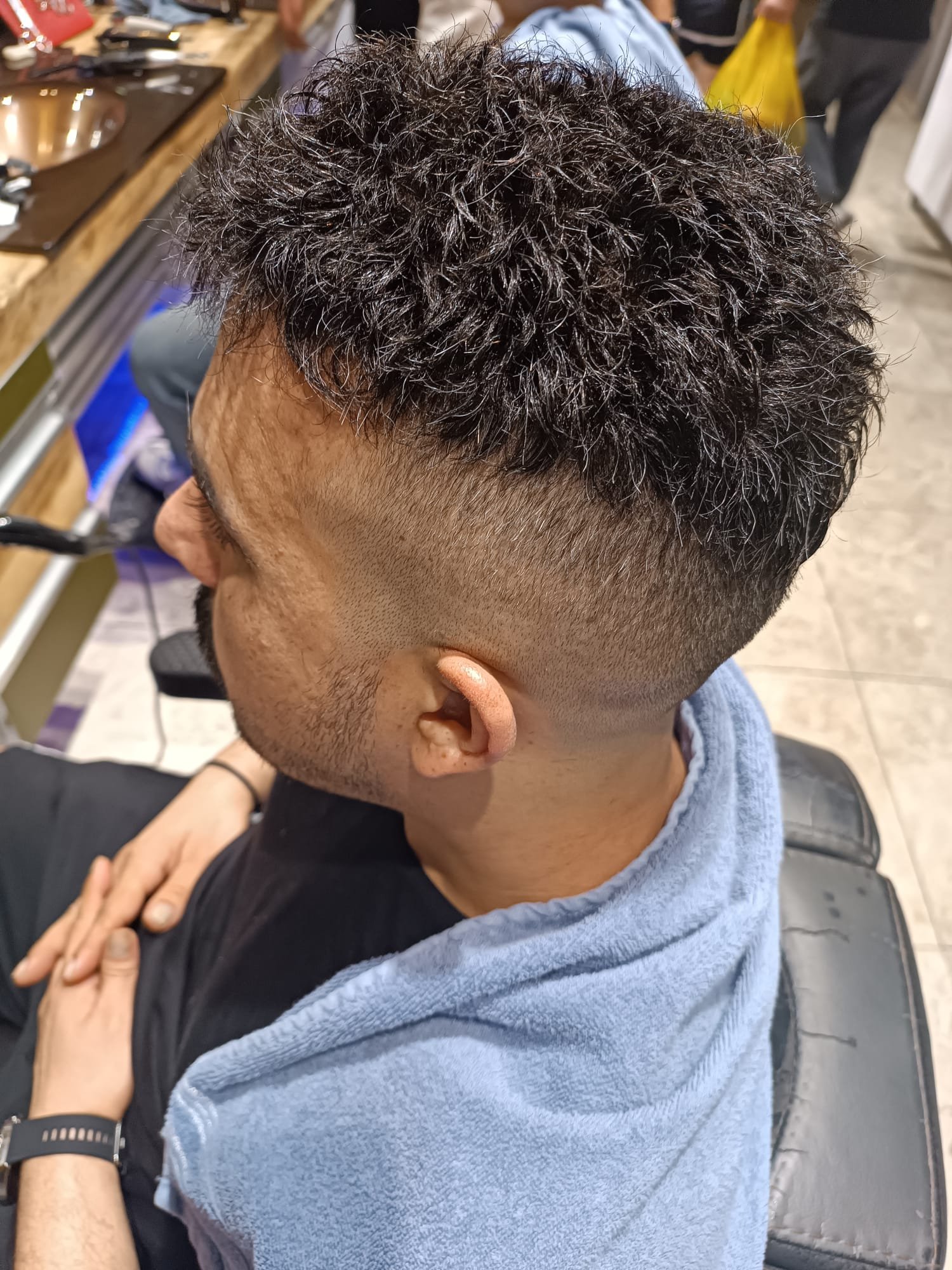 Danışan 03 protez saç çalışması — Eko Hair İstanbul