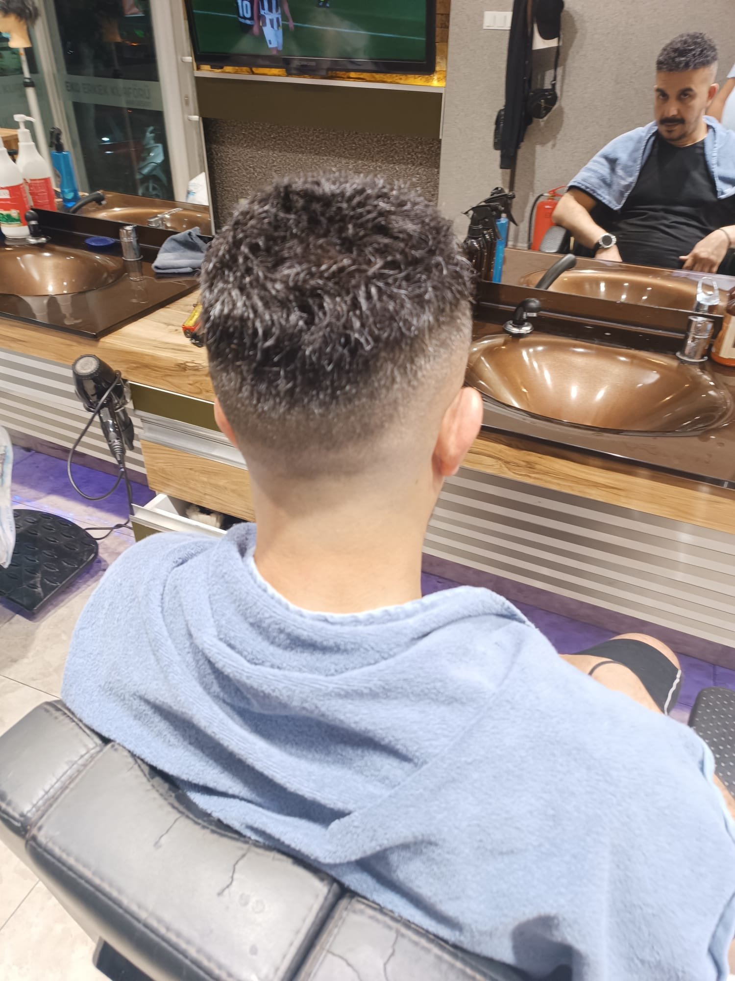 Danışan 03 protez saç çalışması — Eko Hair İstanbul