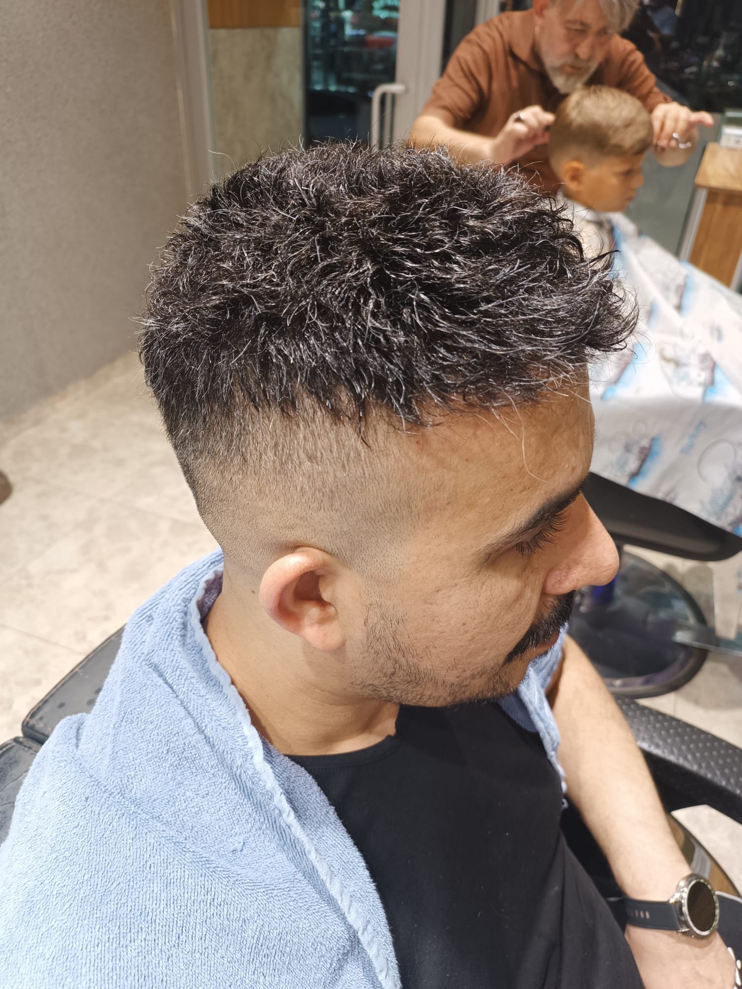 Danışan 03 protez saç çalışması — Eko Hair İstanbul
