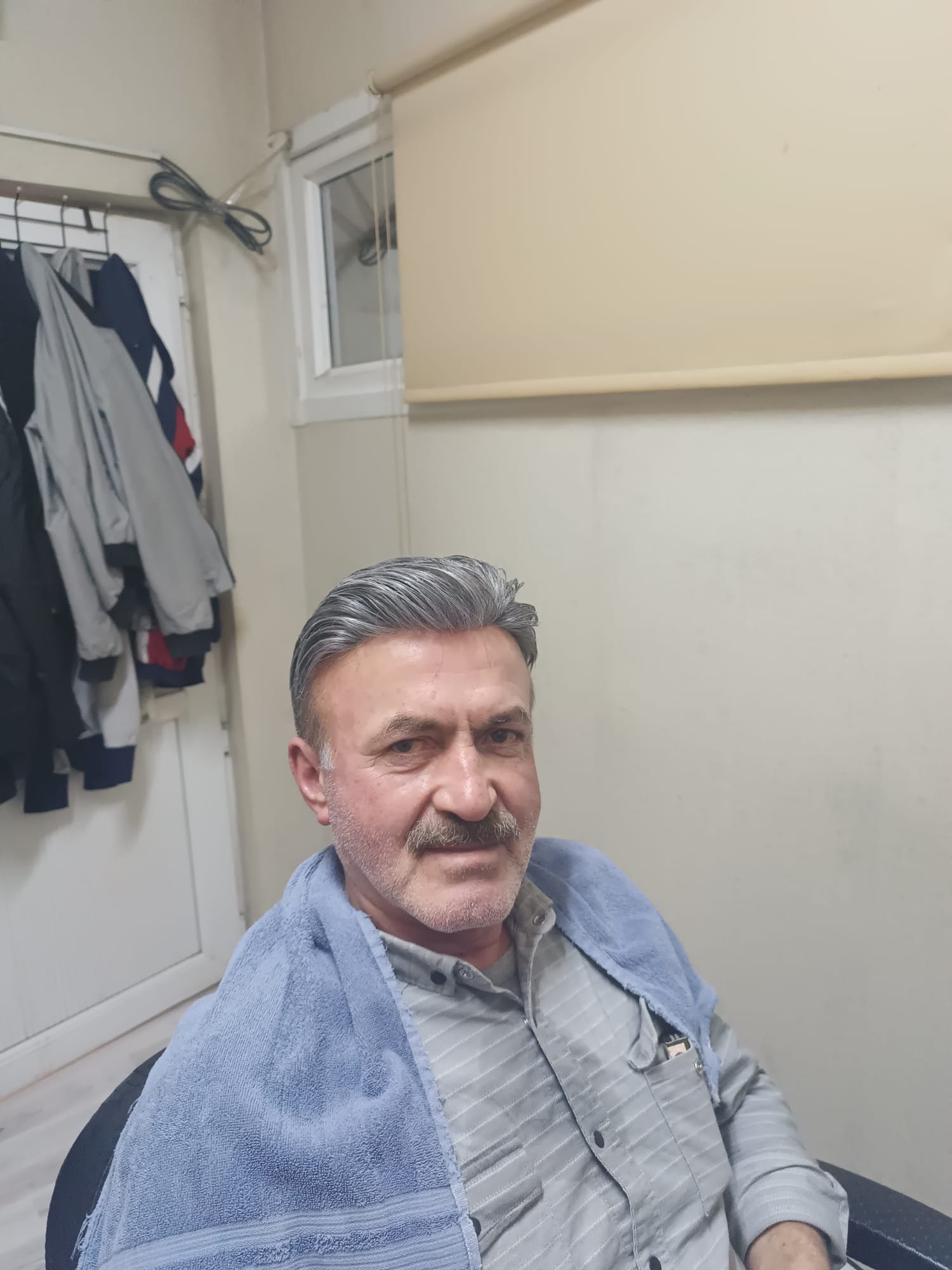 Sonrası — Eko Hair protez saç