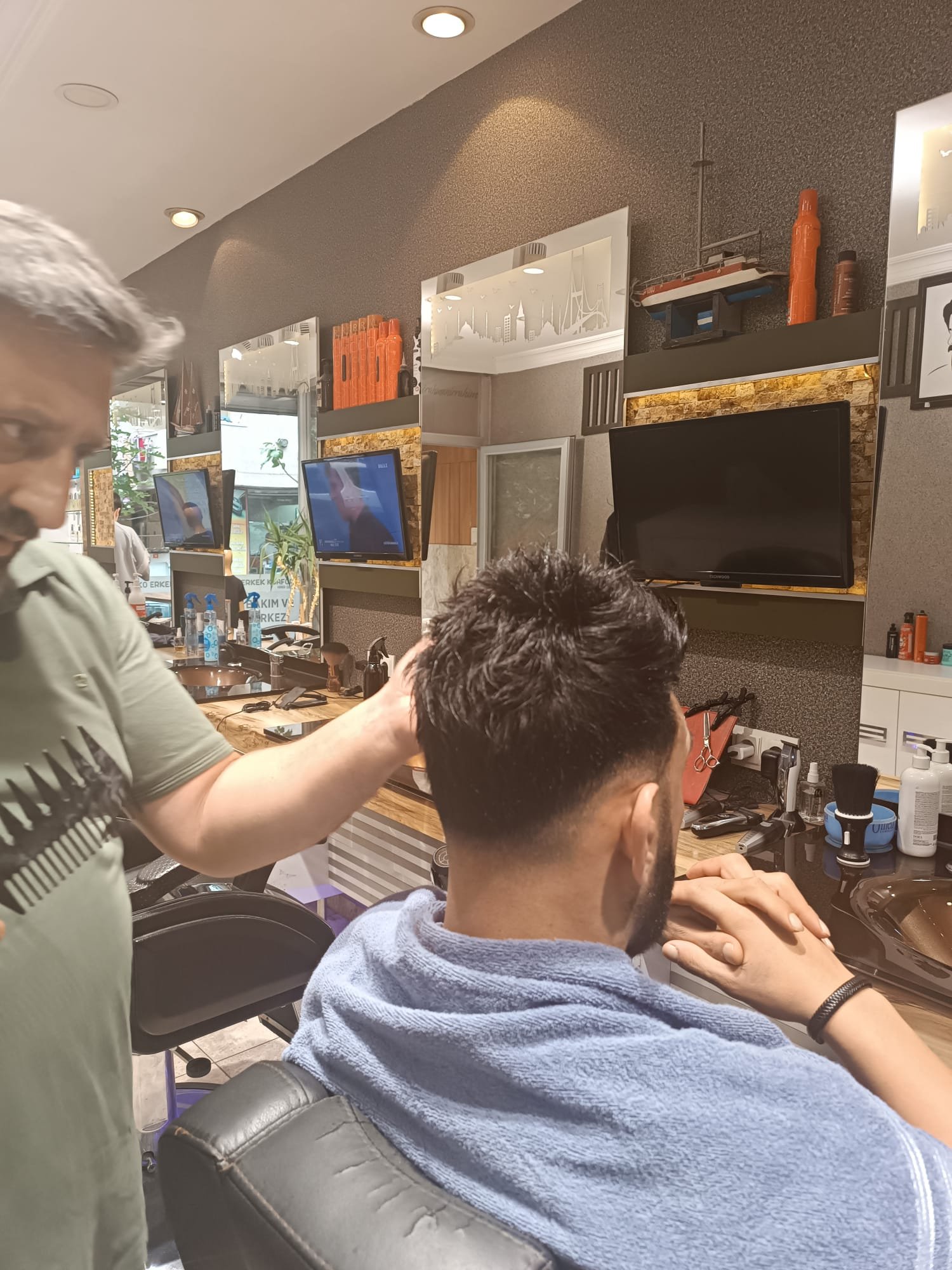 Sonrası — Eko Hair protez saç